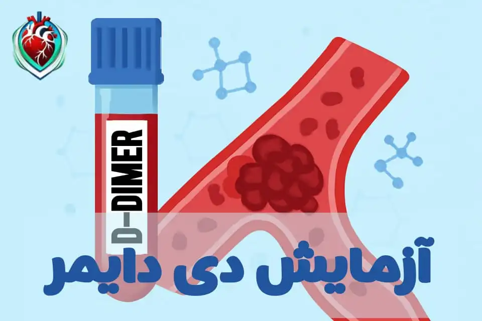 آزمایش دی دایمر به عنوان ابزاری برای شناسایی لخته‌های خون و بررسی مشکلات ترومبوتیک در بدن.