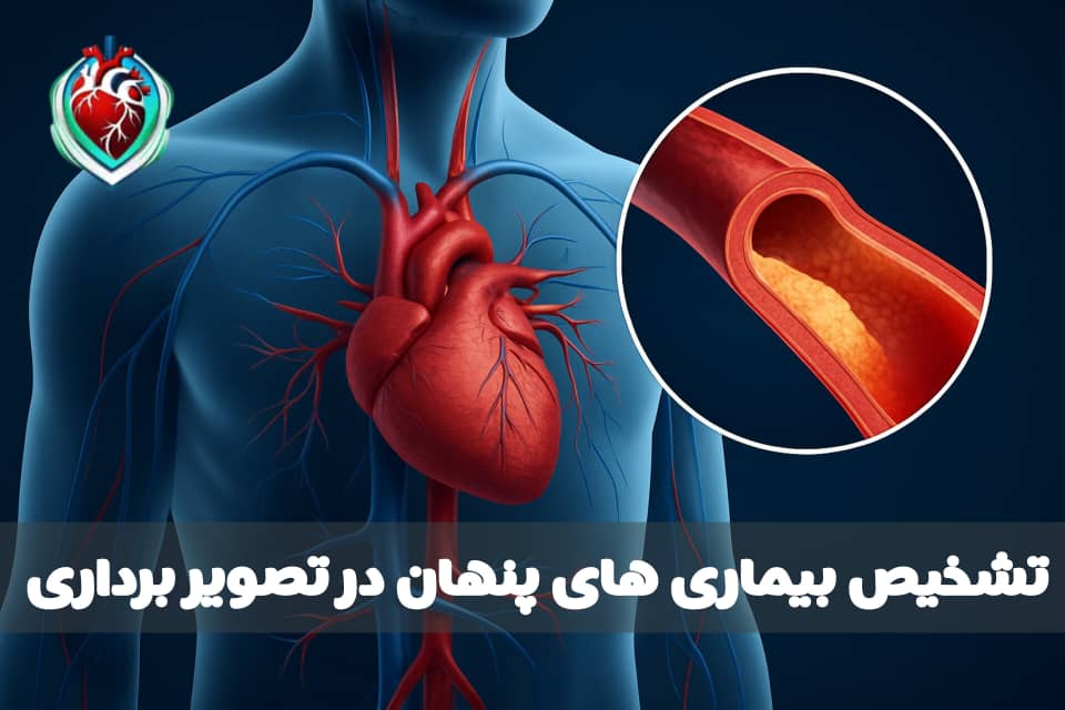 تشخیص بیماری‌های قلبی پنهان در تصویربرداری